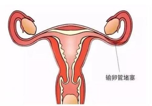 杭州试管代怀生子：﻿新疆产假最新标准，产假最长可达158天